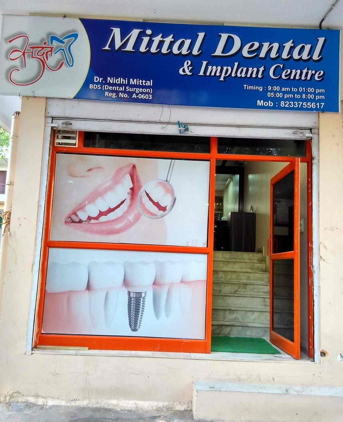 Mittal Dental